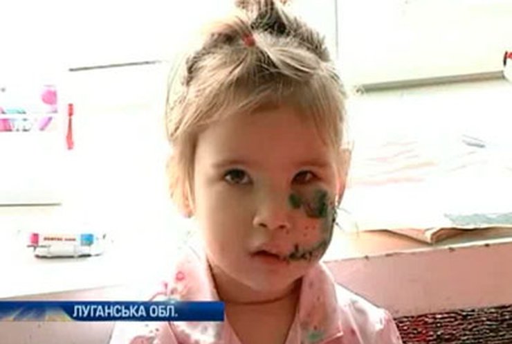 На Луганщине бойцовский пес искусал трехлетнюю девочку