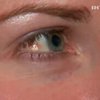 В США становятся популярными украшения-имплантанты в глазу