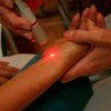 Защититься от гриппа поможет лазерное излучение