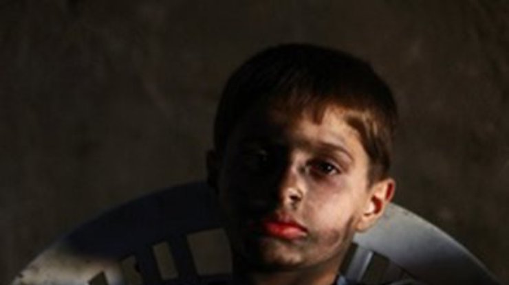 В Сирии в результате бомбардировки погибли дети