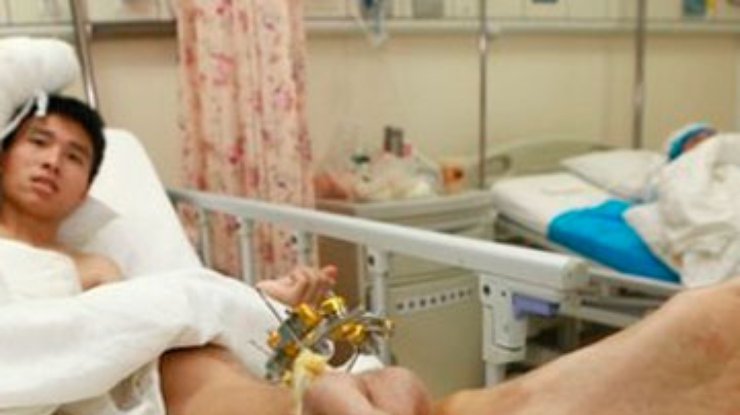 Китайские врачи сохранили жизнь в оторванной руке, временно пришив ее к ноге пациента