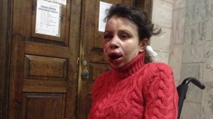 Под Борисполем неизвестные избили журналистку Чорновил (обновлено 10.01)