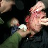 Юрию Луценко разбили голову (обновлено)