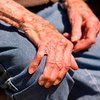 Успешно протестирована новая методика лечения болезни Паркинсона