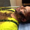 Кожара не увидел на Булатове следов пыток: Единственная его травма - царапина