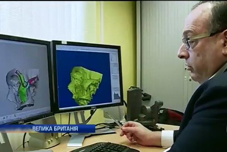 Валлийские врачи восстановили пациенту лицо с помощью 3D-распечатки