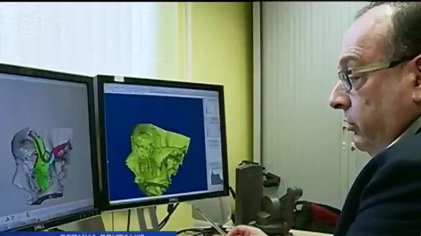 Валлийские врачи восстановили пациенту лицо с помощью 3D-распечатки