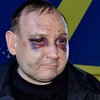 Шахтер с Донбасса о пытках в плену: Били за то, что бандеровец (фото, видео)