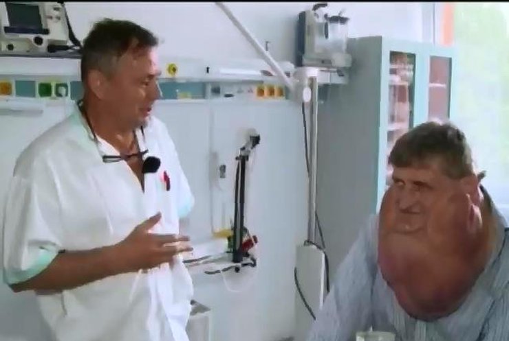 Словацкие доктора удалили пациенту гигантскую опухоль на лице