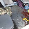 При обстреле "Газели" в Мариуполе погибли 5 пограничников, 7 - ранены (видео)