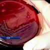 75 вчених із США могли заразитися сибірською виразкою