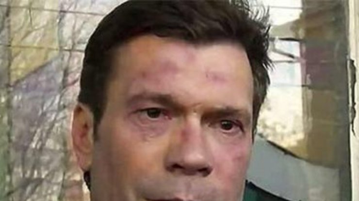Побитый в Донецке Царев сейчас в России и у него "никаких проблем нет"