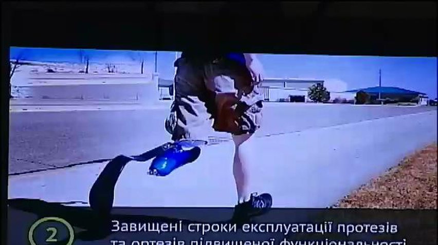Минсоцполитики не обеспечивает раненых солдат протезами