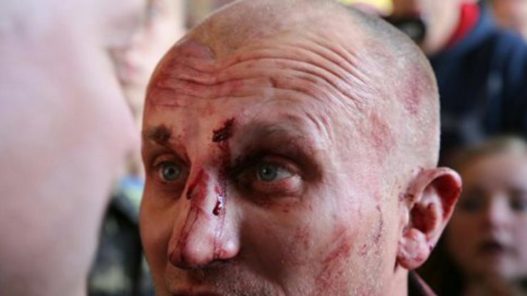В Киеве из-за беркутовца Садовника избили активиста Майдана (фото)