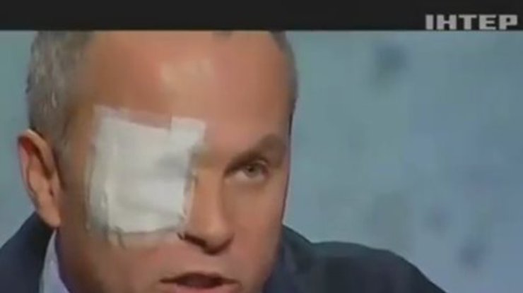 Шуфрич вспомнил о шраме c декабрьского Майдана  (видео)