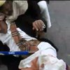 40 людей загинуло внаслідок теракту смертника у Ємені