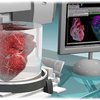 3D-модель сердца поможет в лечении детей
