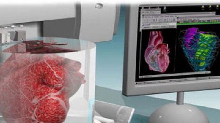 3D-модель сердца поможет в лечении детей