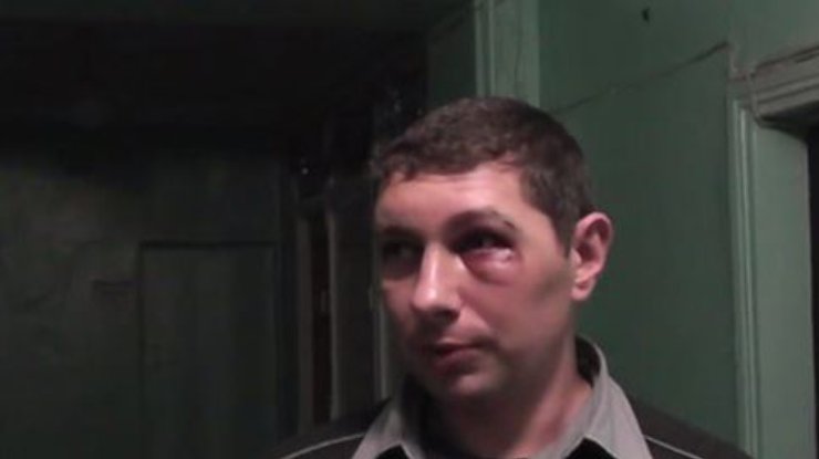 В Никополе таксисты избили киборга до потери сознания (видео)