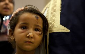 Девочка, выжившая после воздушной атаки