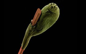 Яйцо вши на человеческом волосе (электронный микроскоп)
