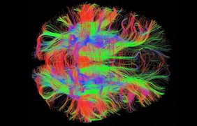 Нервные волокна мозга (МРТ)