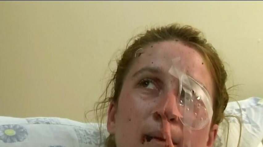 В Ізраїлі хірурги відновили зір пораненій міліціонерці зі Львова