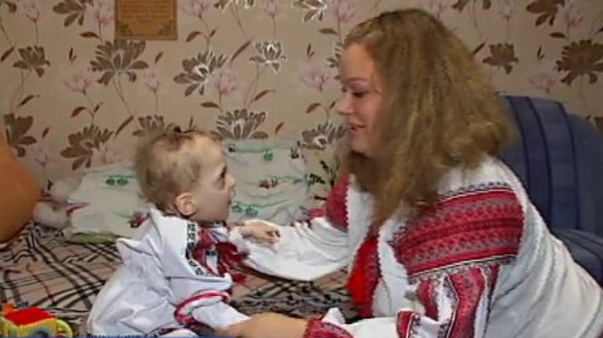 Маленька Евангеліна потребує лікування родової травми