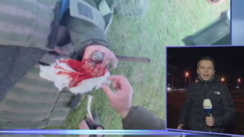 В Одессе хирурги вытащили курсанту гранату из руки