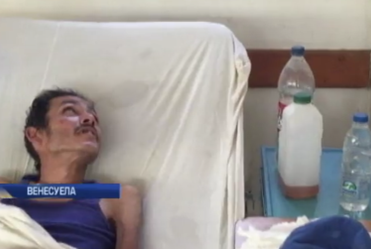 У лікарнях Венесуели помирають люди через нестачу фінансування