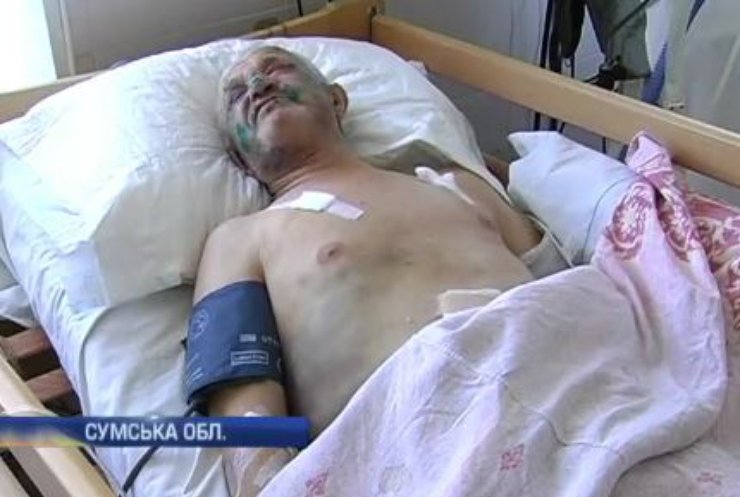 На Сумщині пенсіонера намагалися вбити за 42 гривні