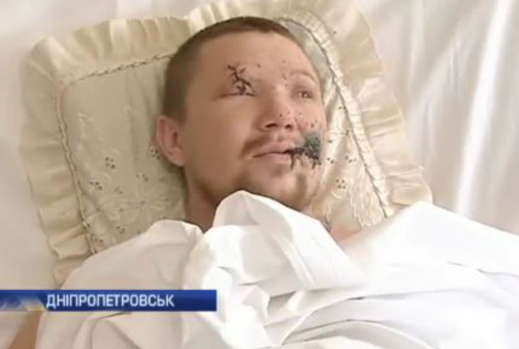 У Дніпропетровську лікують бійця після підриву на міні у Широкиному
