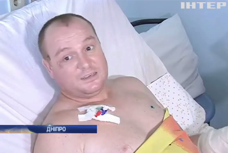 У лікарнях Дніпра із поранених витягують кілограми осколків