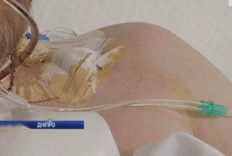 Медики Дніпра рятують життя двох поранених на фронті