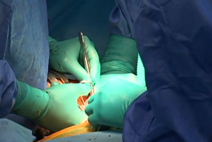 В Україні запрацювала єдина база трансплантації