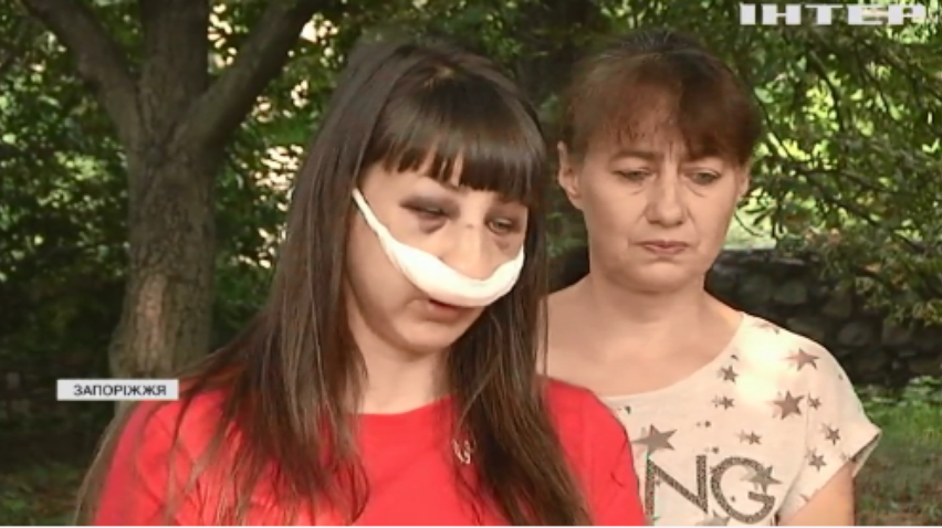 Переслідування колишньої: у Запоріжжі чоловік жорстоко побив дівчину
